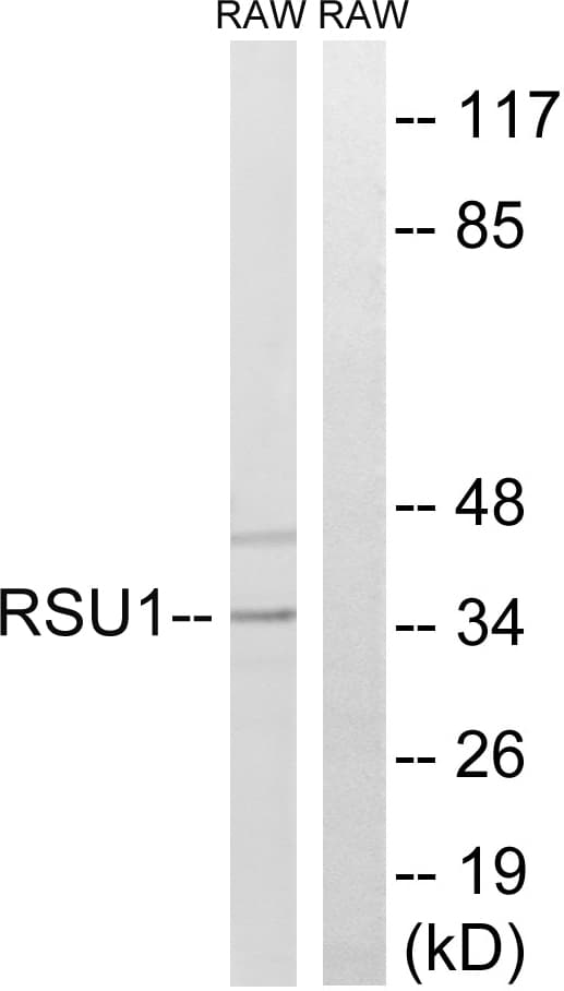 RSU1 Antibody (aa187-236)