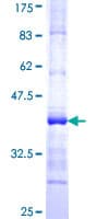Human ALAS1 Protein (Recombinant GST, N-terminus)