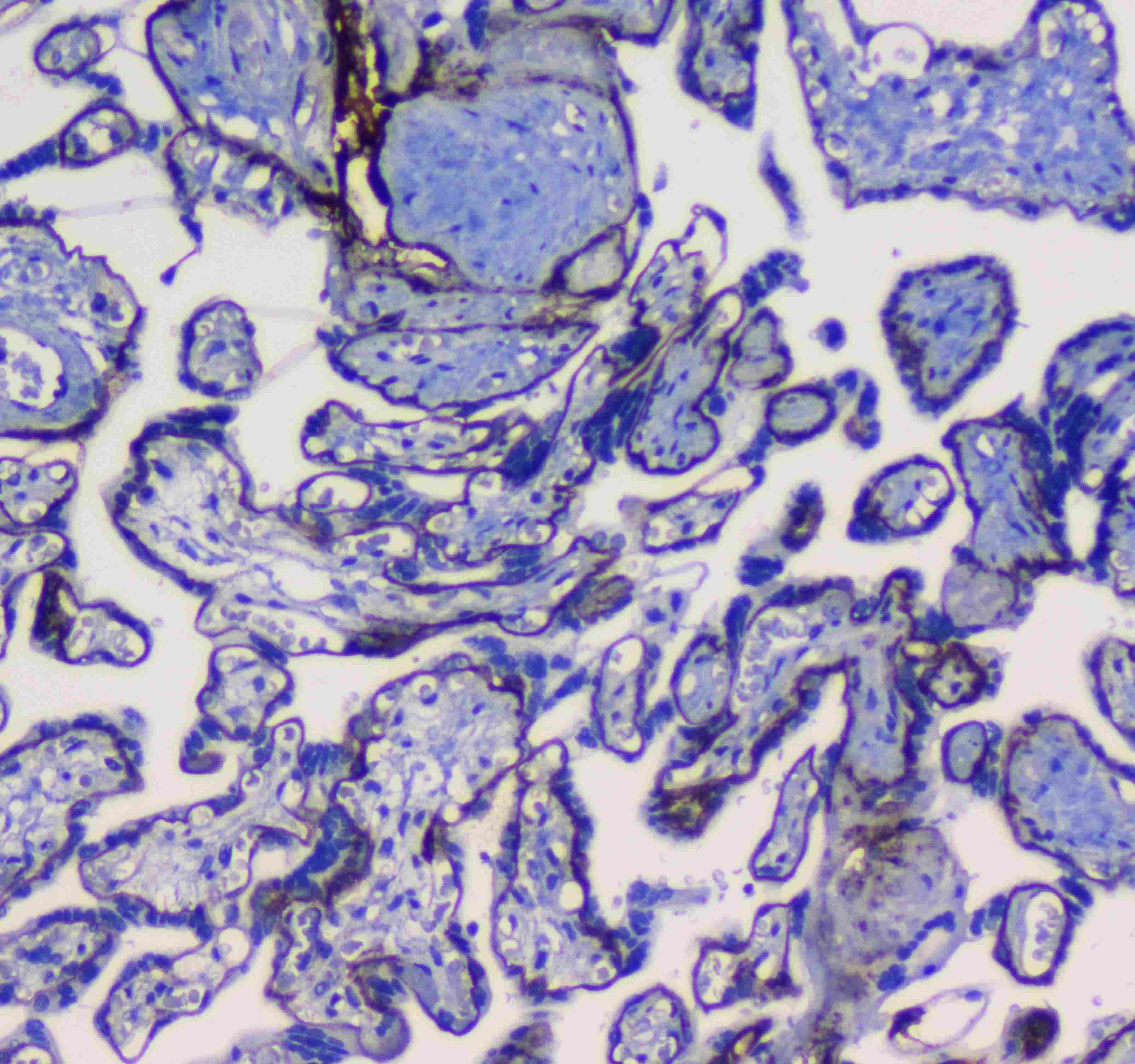 Polyclonal Rabbit anti-Human ITGA5/Integrin Alpha 5/CD49e Antibody (IHC, WB)