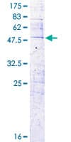 Human CFC1 Protein (Recombinant GST)