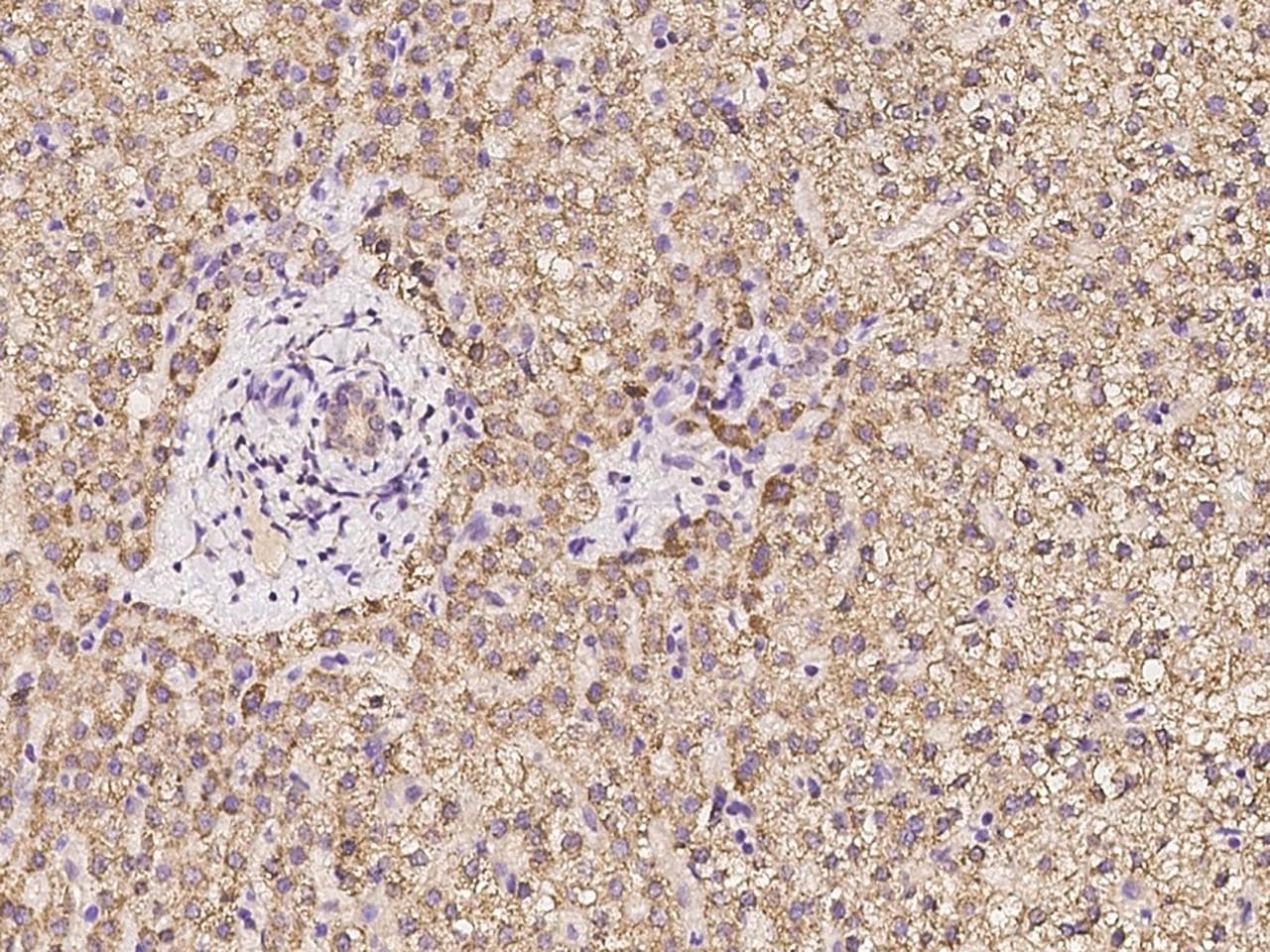 Polyclonal Rabbit anti-Human HMGCL Antibody (IHC, IF)
