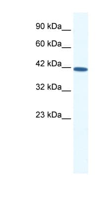 SOX11 Antibody (N-Terminus)