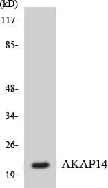 Polyclonal Rabbit anti-Human AKAP14 Antibody (aa5-54, WB)