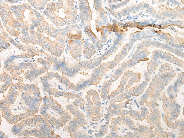 CELA3A / ELA3 Antibody