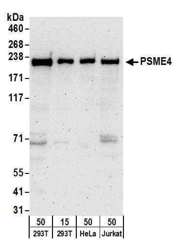 Polyclonal Rabbit anti-Human PSMD2 Antibody (aa50-100, IHC, WB)