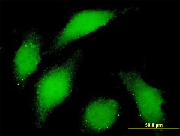 Monoclonal Mouse anti-Human BUB1 Antibody (clone 4C3-4C9, IF, WB)