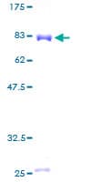 Human PGD Protein (Recombinant GST)