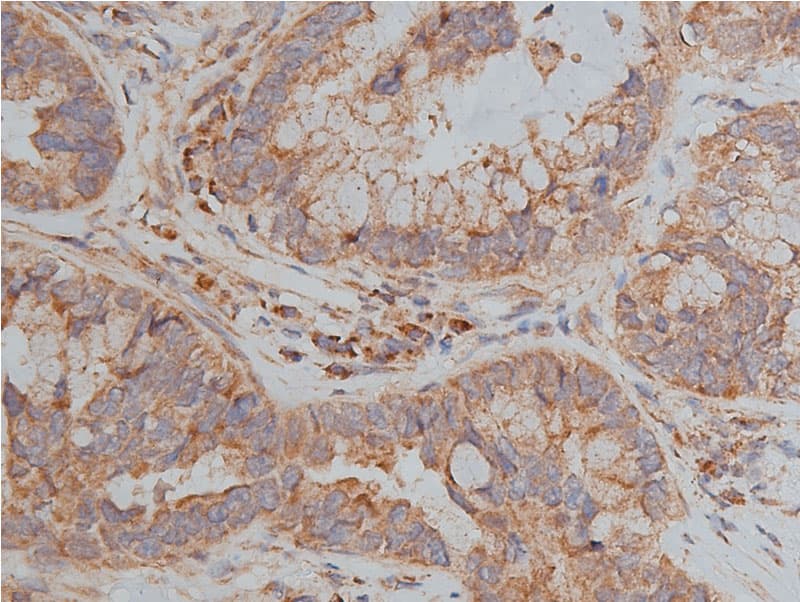 Hamartin / TSC1 Antibody