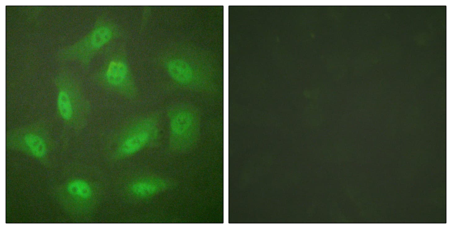 IHC-plus™ COPS3 / CSN3 Antibody (aa374-423)