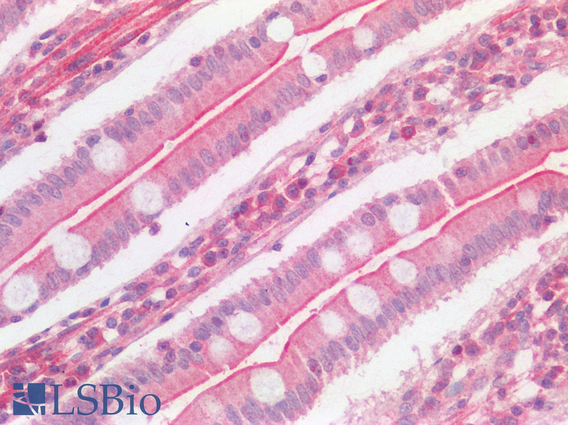 PathPlus™ ACE2 / ACE-2 Antibody
