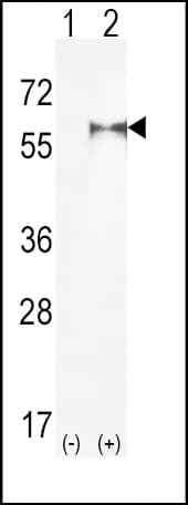Polyclonal Rabbit anti-Human PIP5K1A Antibody (aa19-50, WB)