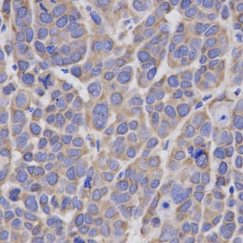 Polyclonal Rabbit anti-Human HMG-CoA Reductase / HMGCR Antibody (IHC, IF, WB)