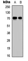Polyclonal Rabbit anti-Human E2F1 Antibody (C-Terminus, IHC, WB)