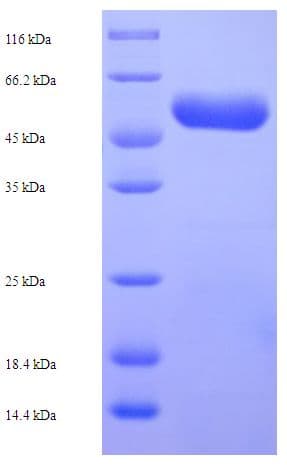 E. coli CFA/I Fimbrial Subunit E Protein (Recombinant His-SUMO)