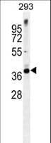STX16 / Syntaxin 16 Antibody (aa247-274)