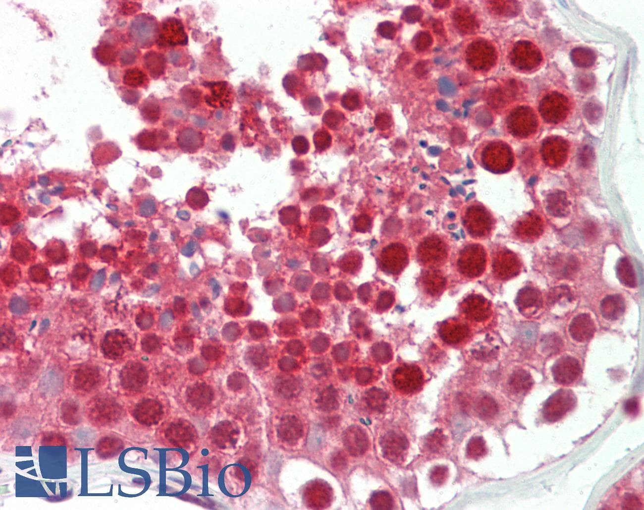 BRD8 Antibody (aa539-588)