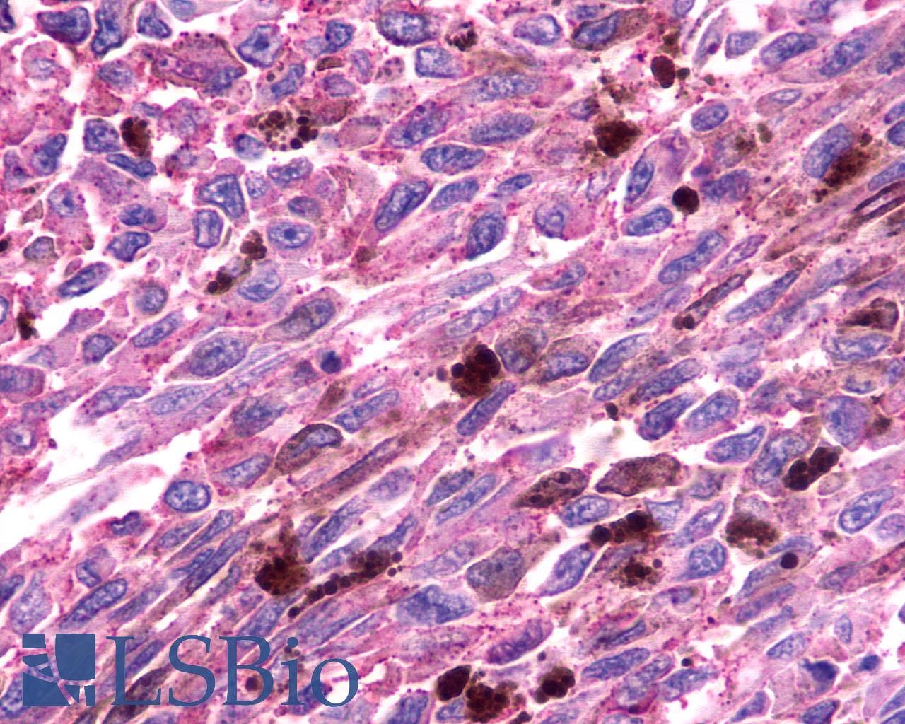 PathPlus™ Polyclonal Rabbit anti-Human FKSG80 / GPR81 Antibody (C-Terminus, IHC)