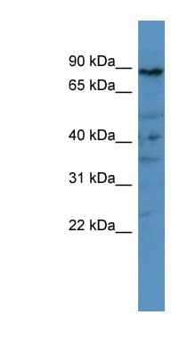 Polyclonal Rabbit anti-Human PDE8A Antibody (aa551-600, WB)
