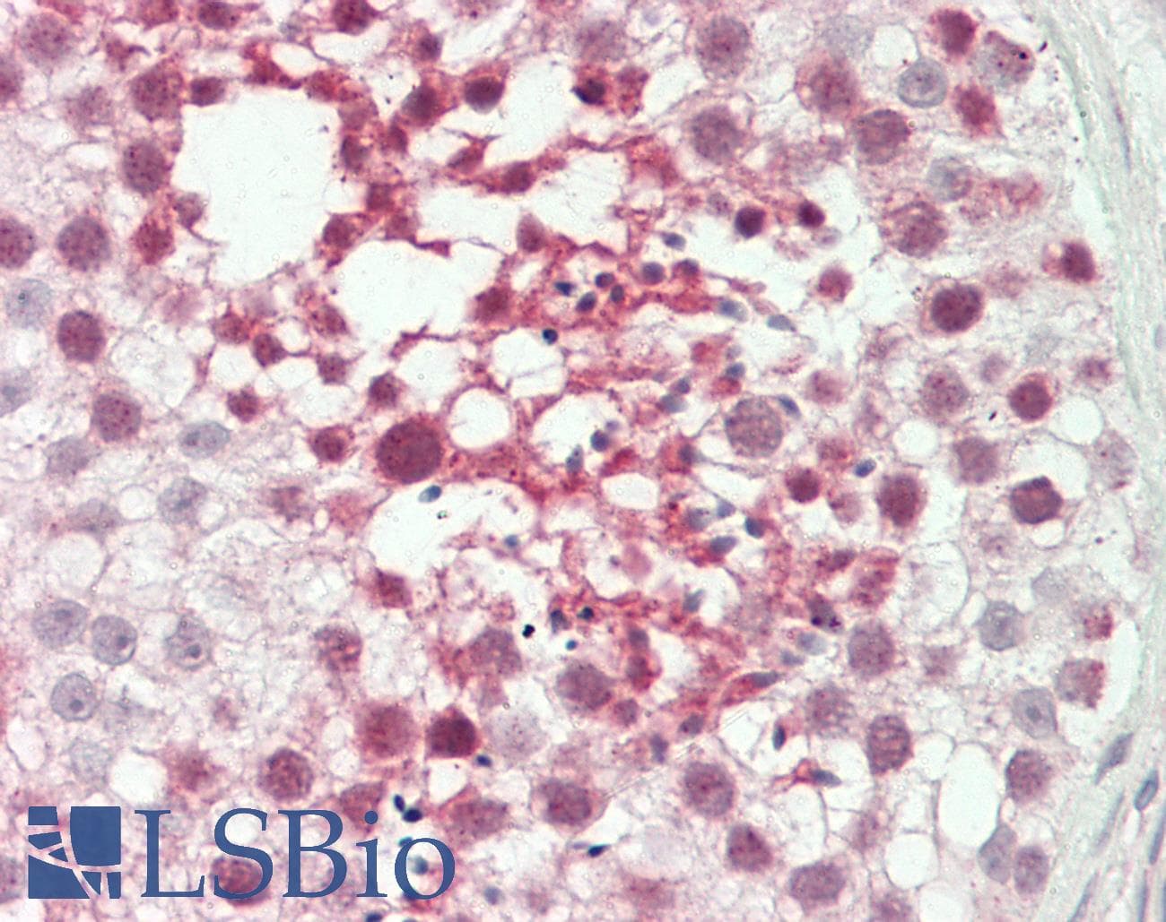 IHC-plus™ Polyclonal Rabbit anti-Human ATF7IP2 Antibody (aa318-347, IHC, WB)
