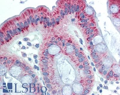 IHC-plus™ CHM / REP1 Antibody