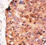 Polyclonal Rabbit anti-Human APOBEC3G / CEM15 Antibody (aa352-384, IHC, WB)