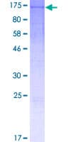 Human WDR63 Protein (Recombinant GST)