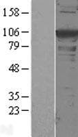 ACTN1 Protein (Over-Expression Lysate Myc-DDK (Flag))