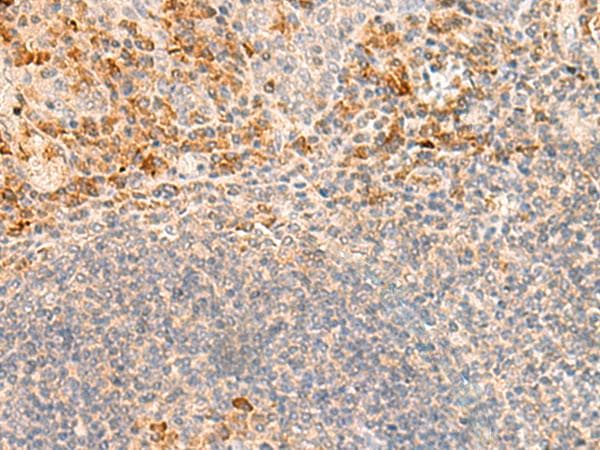 GRM2 / MGLUR2 Antibody