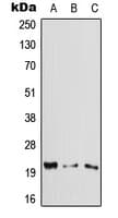 Polyclonal Rabbit anti-Human CYGB / Cytoglobin Antibody (Internal, WB)