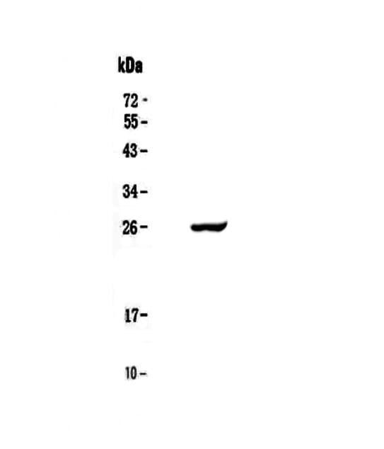 Polyclonal Rabbit anti-Human APCS / Serum Amyloid P / SAP Antibody (IHC, WB)