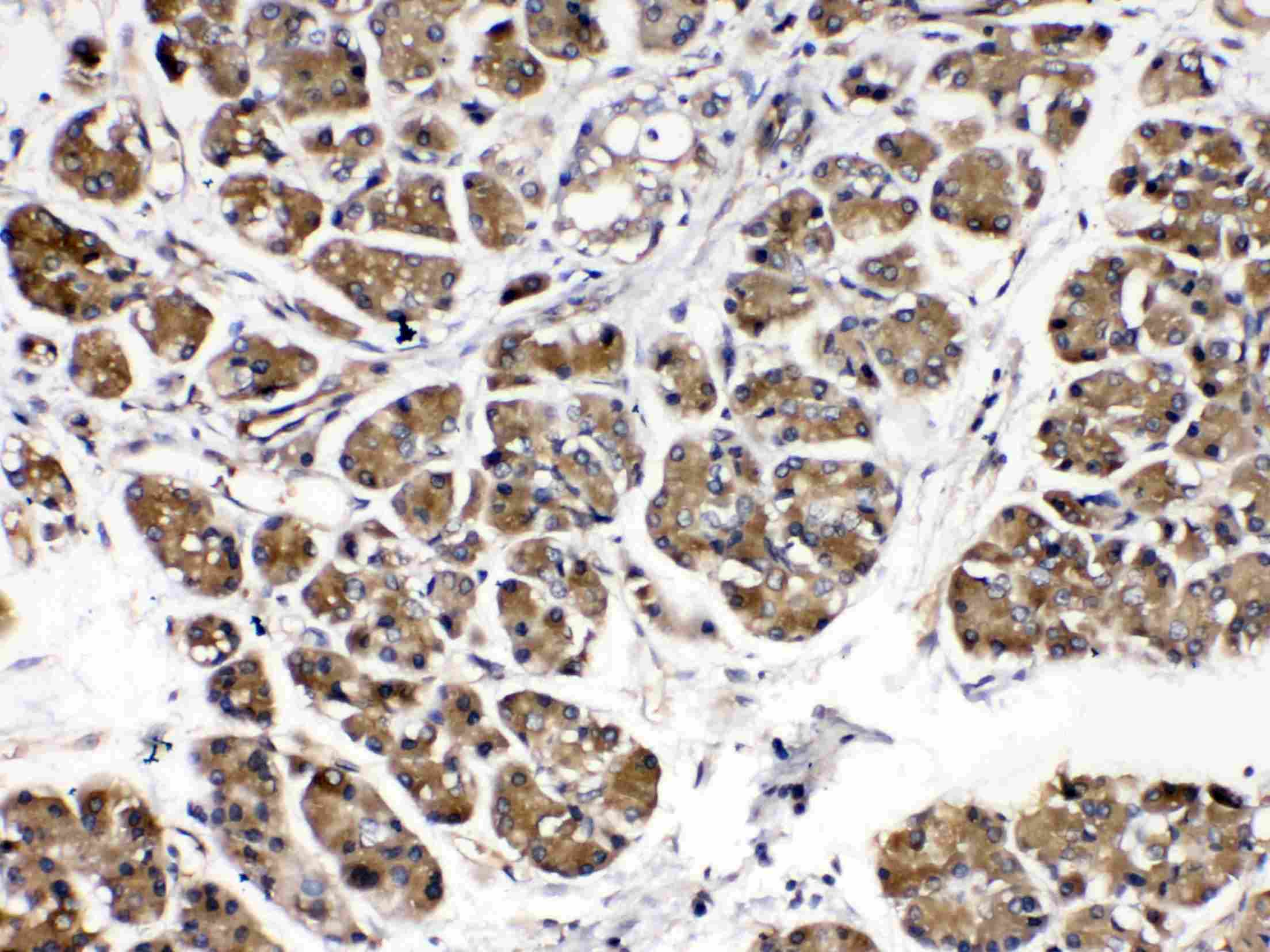Polyclonal Rabbit anti-Human AMY1A + AMY1B + AMY1 Antibody (IHC, WB)