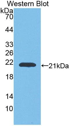GAA / Alpha-Glucosidase, Acid Antibody (aa70-225)
