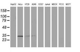 NMNAT1 / NMNAT Antibody (clone OTI1G4)
