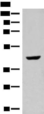 GNAT1 Antibody