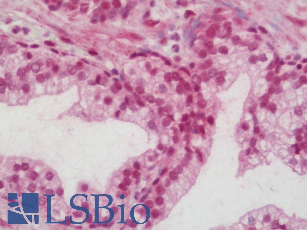 IHC-plus™ Polyclonal Rabbit anti-Human HIF1A / HIF1 Alpha Antibody (aa328-377, IHC, WB)
