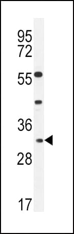 Polyclonal Rabbit anti-Human APOF / Apolipoprotein F Antibody (aa111-138, IHC, WB)