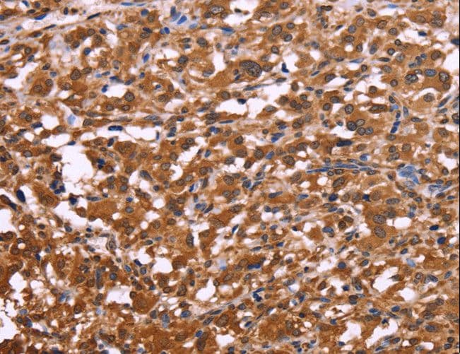 APMAP / C20orf3 Antibody