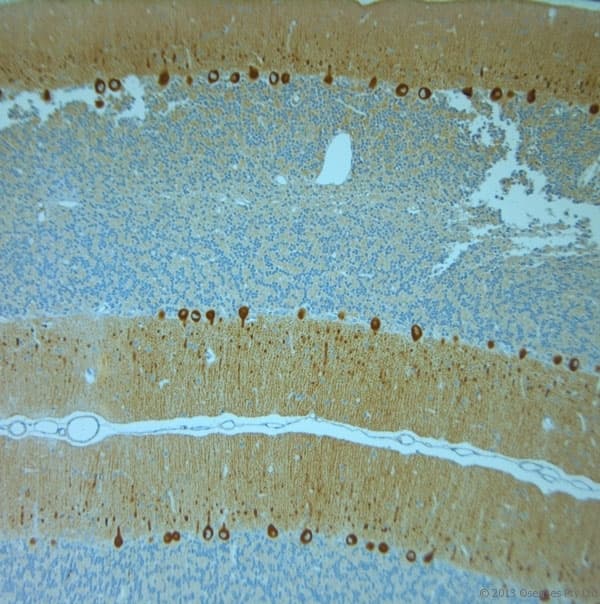 Polyclonal Rabbit anti-Human ITPR1 / IP3 Receptor Type 1 Antibody (aa700-750, IHC)