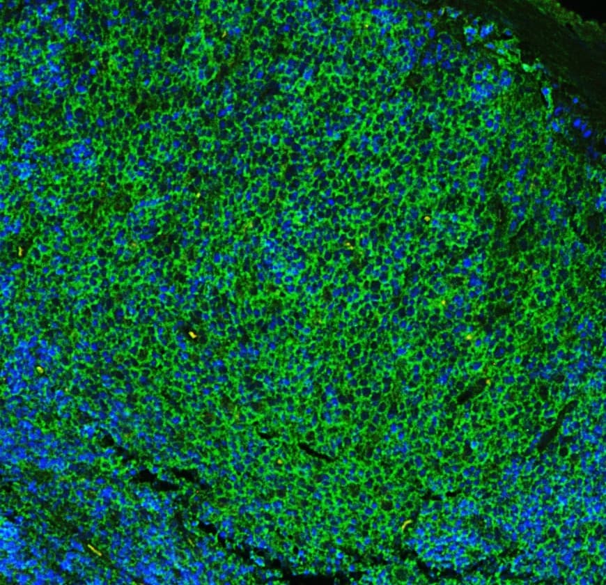 FCER2 / CD23 Antibody (aa50-331)
