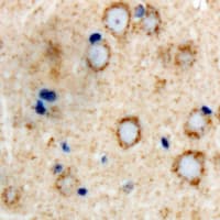 GRIA4 / GLUR4 Antibody (C-Terminus)