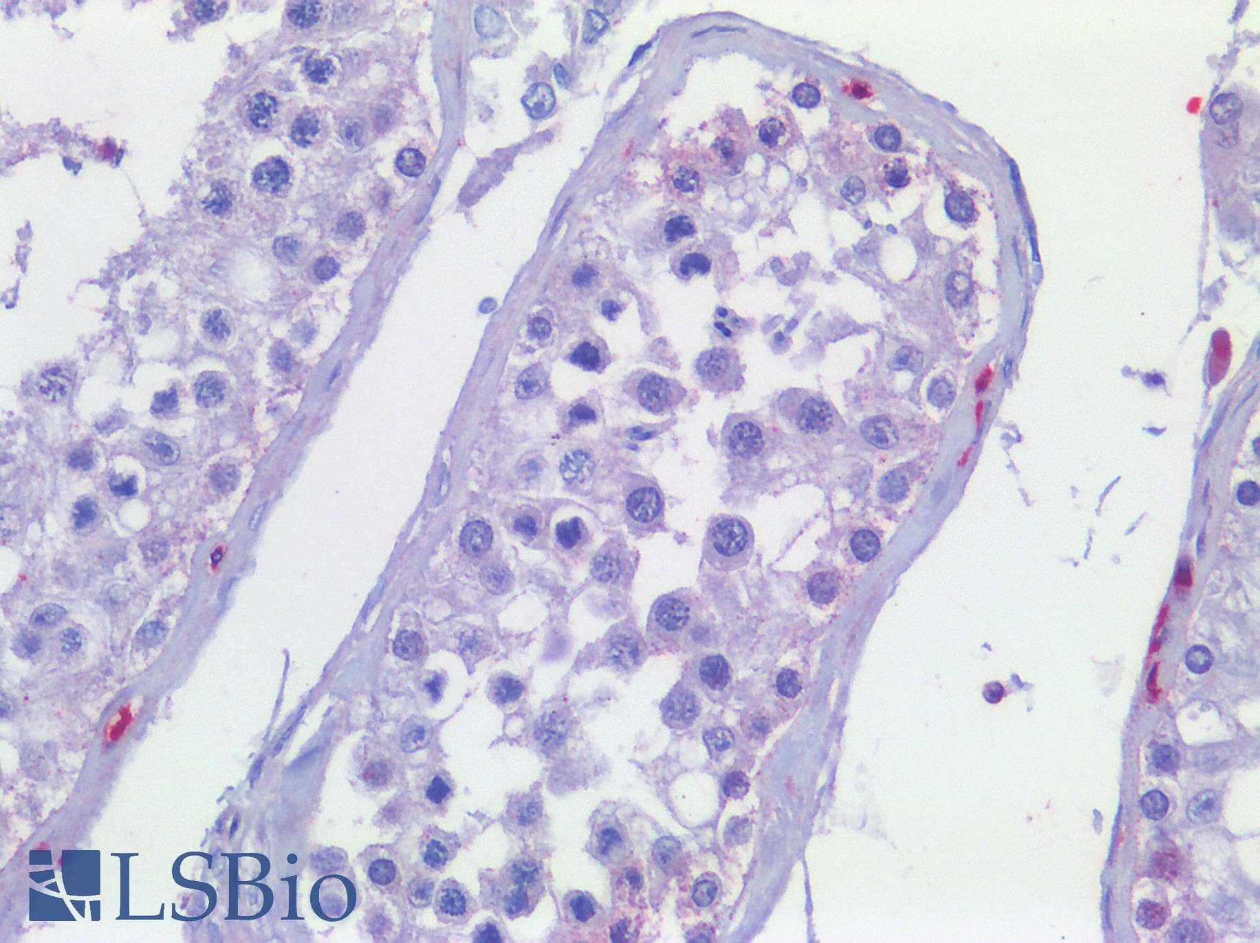 IHC-plus™ SMO / Smoothened Antibody (aa68-117)