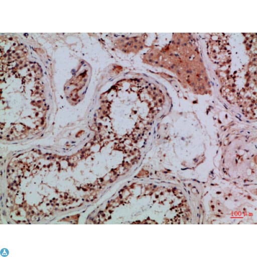 Tubulin Gamma Antibody