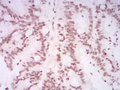 Monoclonal Mouse anti-Human HIST2H4A Antibody (clone 3E7D9, IHC)