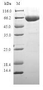 Human ADH1C Protein (Recombinant GST, N-terminus)