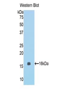 Beta-N-Acetylglucosaminidase Antibody (aa679-808)