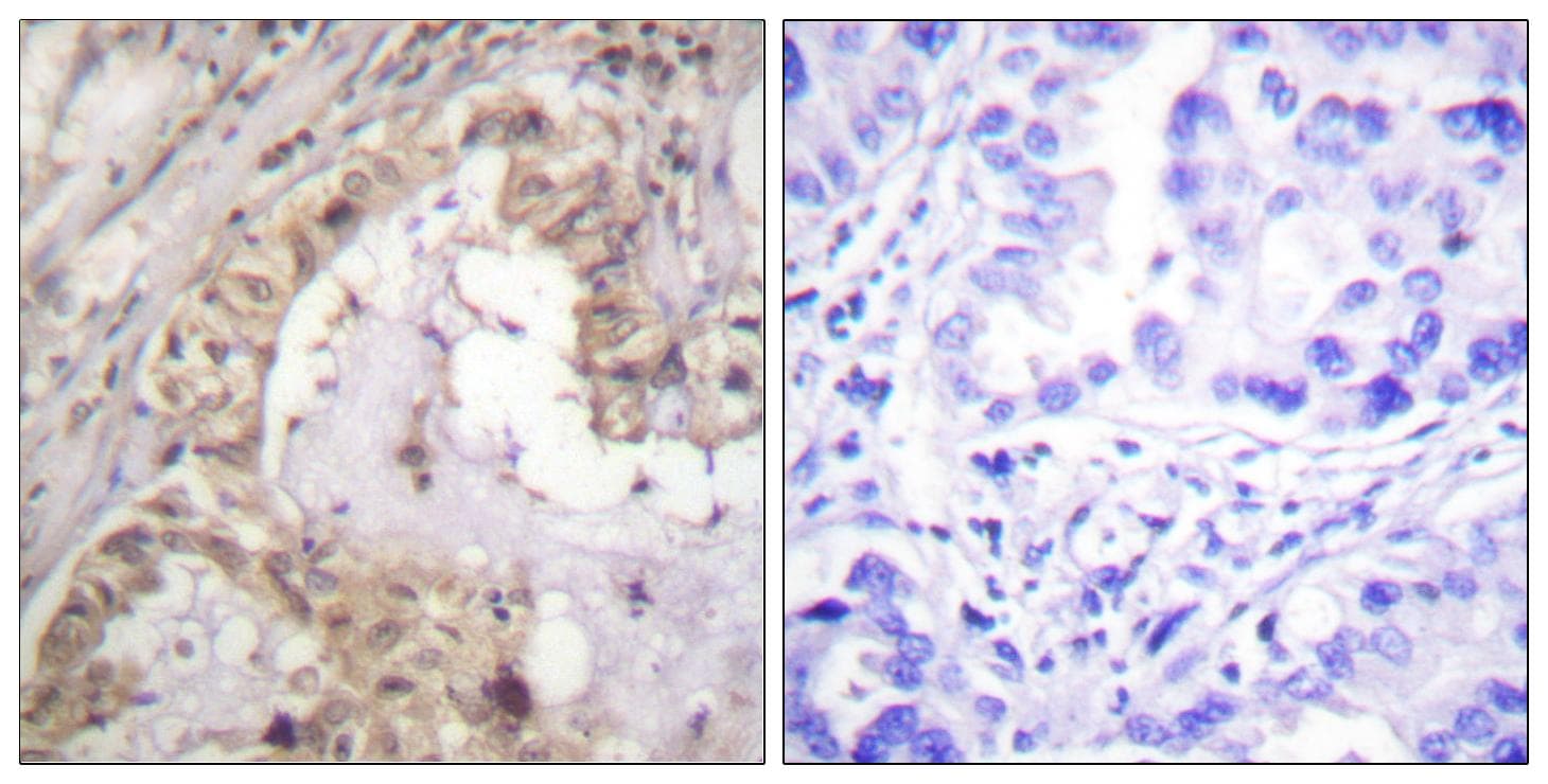 BCL2L1 / BCL-XL Antibody (p47)