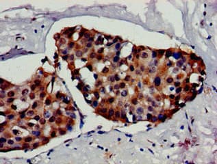 Polyclonal Rabbit anti-Human HSF1 Antibody (IHC, IF, WB)