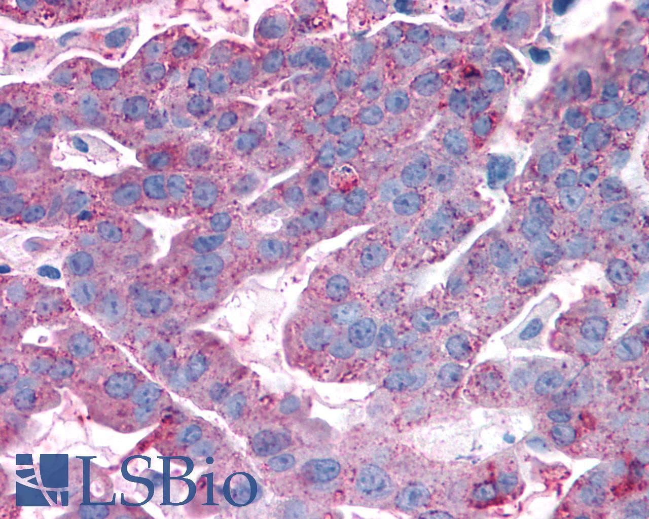 PathPlus™ ADGRG3 / GPR97 Antibody (Extracellular Domain)