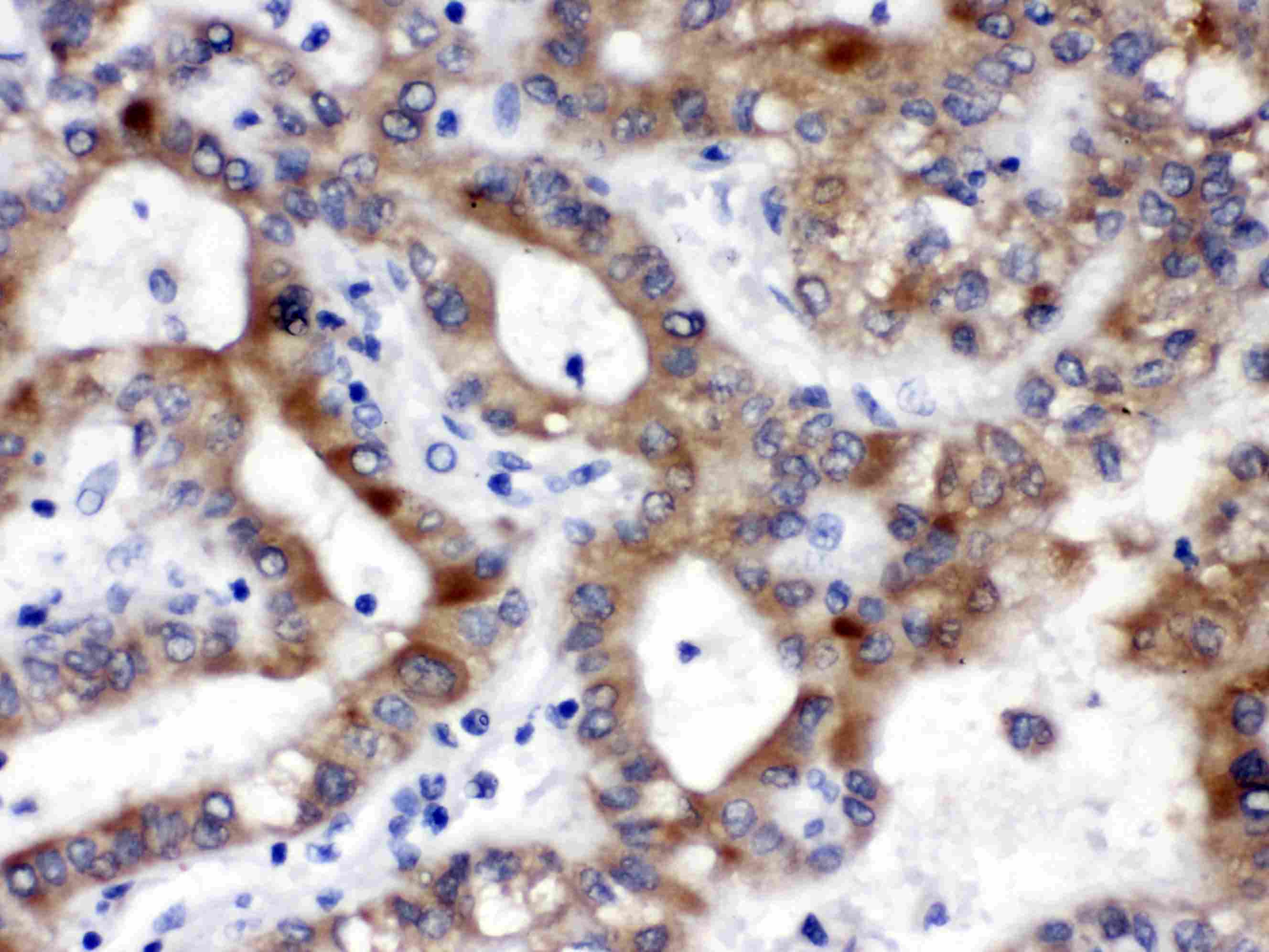ALDH3A2 Antibody