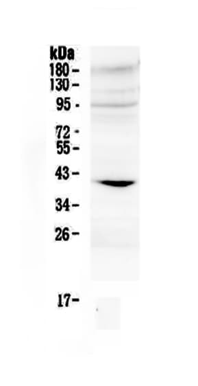 IGFBP3 Antibody